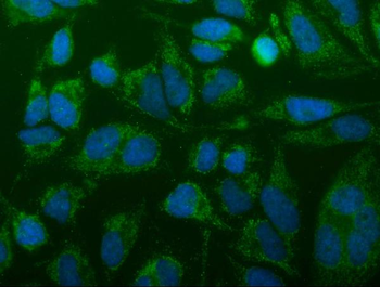 Anti-TTC11/FIS1 Antibody