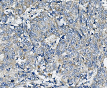 Anti-TTC11/FIS1 Antibody