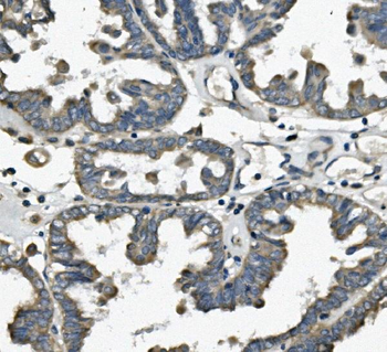 Anti-TTC11/FIS1 Antibody