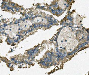 Anti-TTC11/FIS1 Antibody