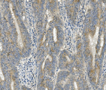 Anti-FRMD6/Willin Antibody