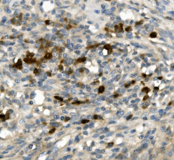 Anti-GFI1 Antibody