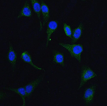 Anti-HGS Antibody