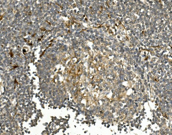 Anti-HGS Antibody