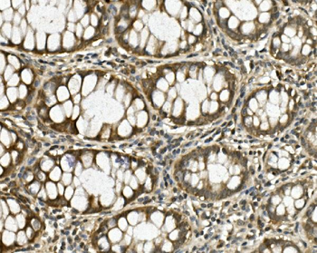 Anti-HGS Antibody