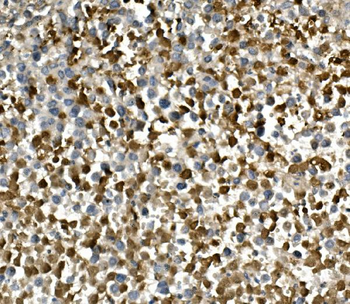 Anti-HGS Antibody