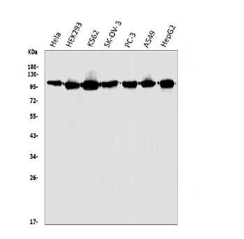 Anti-HGS Antibody