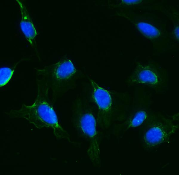 Anti-IFT88 Antibody