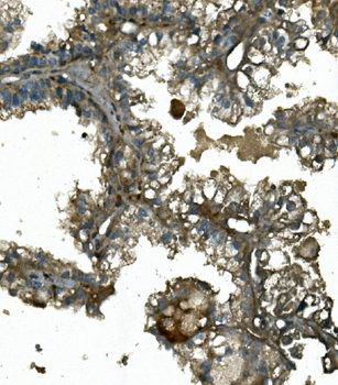 Anti-IFT88 Antibody