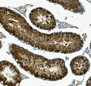 Anti-IFT88 Antibody