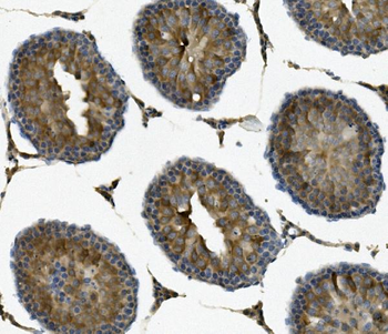 Anti-IFT88 Antibody