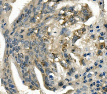 Anti-LDL Receptor/LDLR Antibody