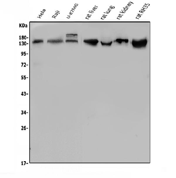 Anti-LDL Receptor/LDLR Antibody