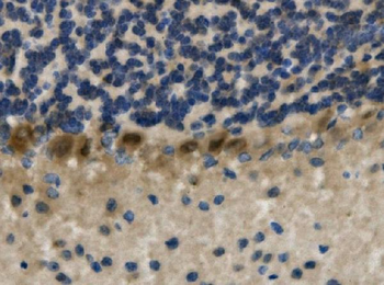 Anti-LIM1/LHX1 Antibody