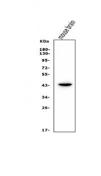 Anti-LIM1/LHX1 Antibody