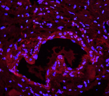 Anti-Lin28/LIN28A Antibody