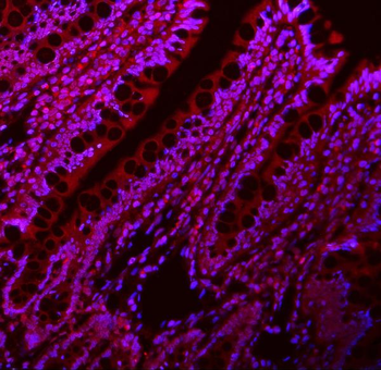 Anti-Lin28/LIN28A Antibody