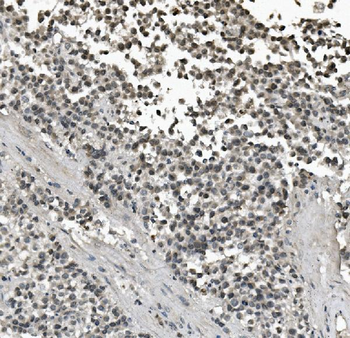 Anti-Lin28/LIN28A Antibody