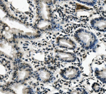 Anti-Lin28/LIN28A Antibody