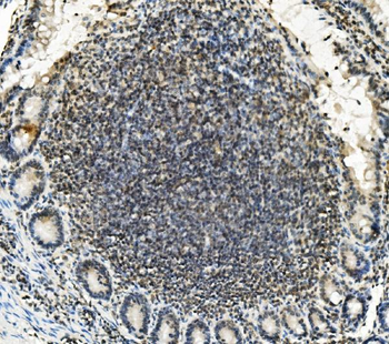 Anti-Lin28/LIN28A Antibody