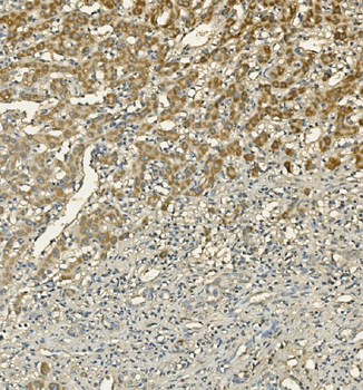 Anti-LIPC Antibody
