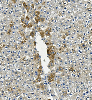 Anti-LIPC Antibody