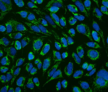 Anti-LRPPRC/GP130 Antibody