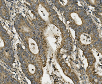 Anti-LRPPRC/GP130 Antibody