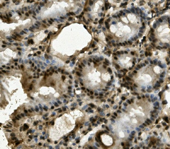 Anti-LRPPRC/GP130 Antibody