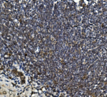 Anti-LRPPRC/GP130 Antibody