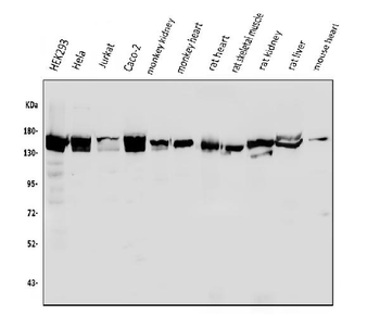 Anti-LRPPRC/GP130 Antibody