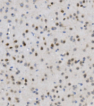 Anti-MBD4/MED1 Antibody