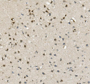Anti-MBD4/MED1 Antibody
