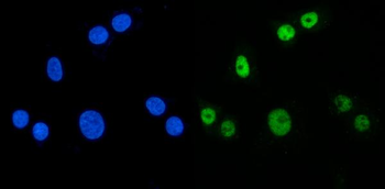 Anti-MBNL1 Antibody