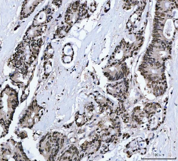 Anti-MBNL1 Antibody