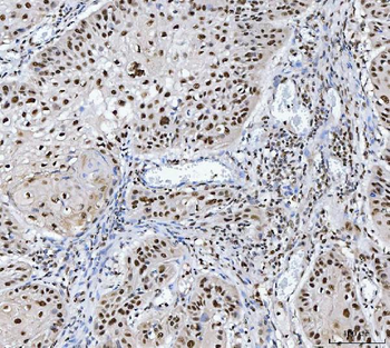 Anti-MBNL1 Antibody
