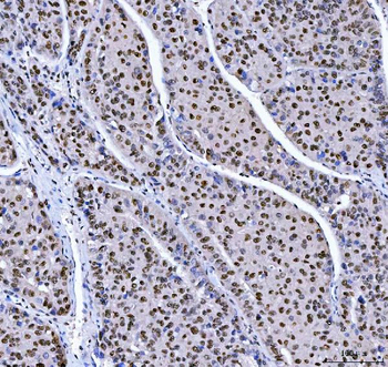 Anti-MBNL1 Antibody