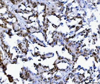 Anti-MBNL1 Antibody