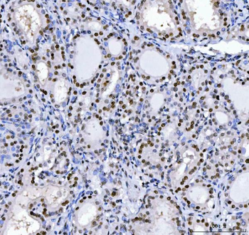 Anti-MBNL1 Antibody