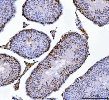 Anti-MBNL1 Antibody