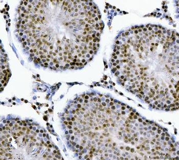 Anti-MBNL1 Antibody
