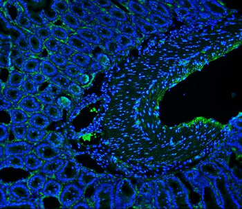 Anti-CD146/Mcam Antibody