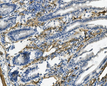 Anti-CD146/Mcam Antibody