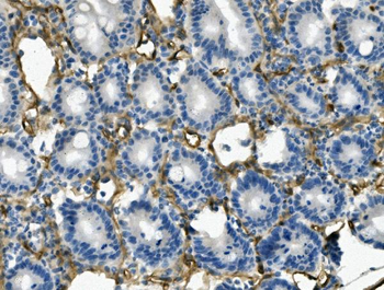 Anti-CD146/Mcam Antibody
