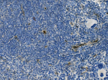 Anti-CD146/Mcam Antibody