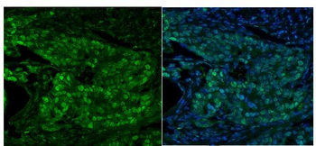 Anti-MCM5 Antibody