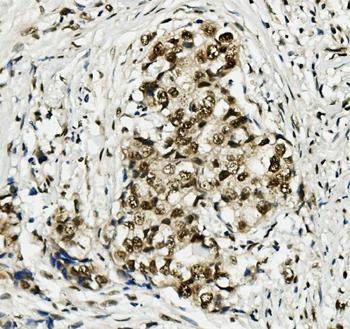 Anti-MCM5 Antibody