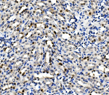Anti-MCM5 Antibody