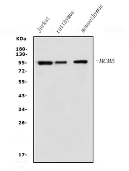 Anti-MCM5 Antibody