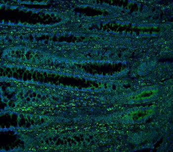 Anti-ME2 Antibody